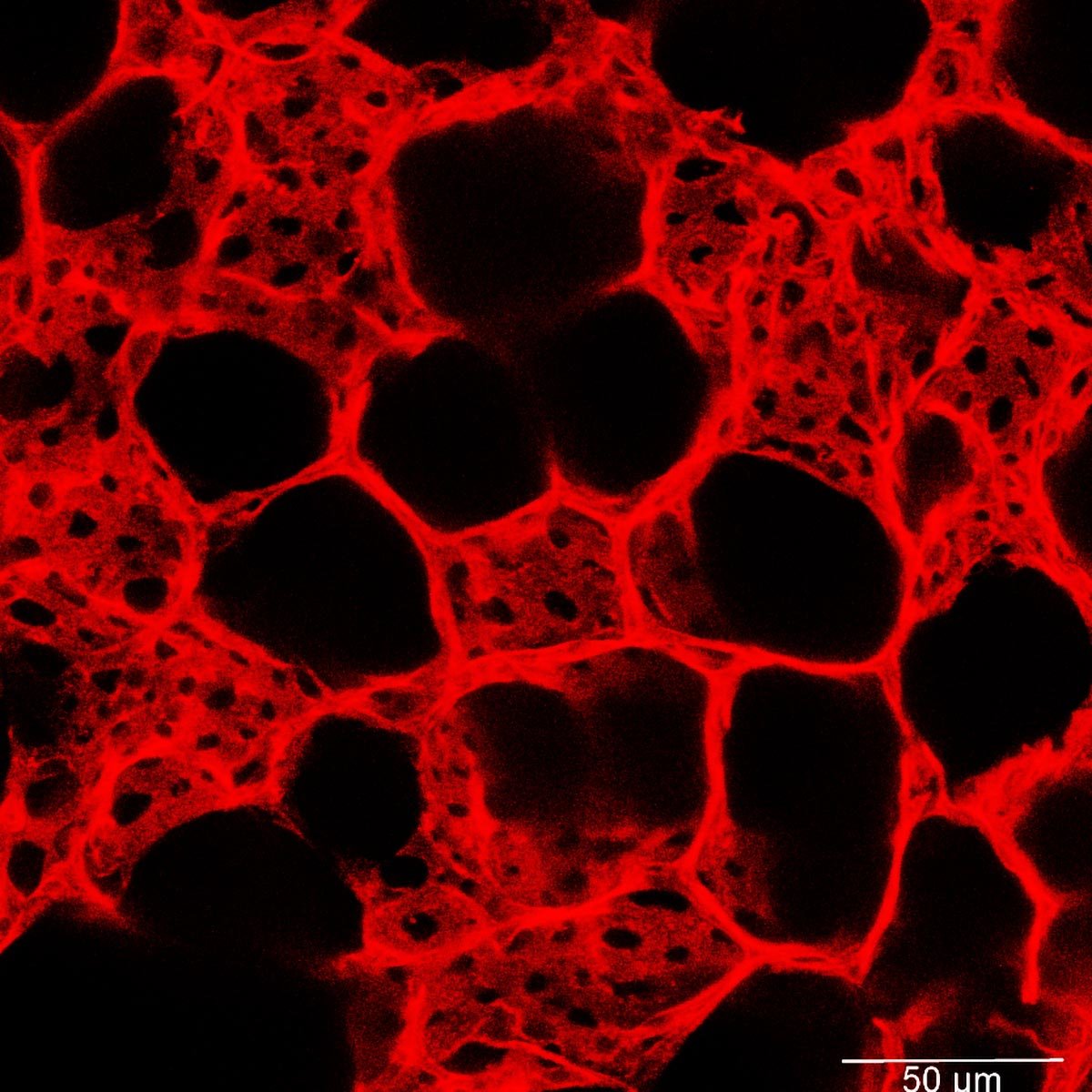 Nanoparticles Repair Lung Tissue Damaged From Flu or COVID-19