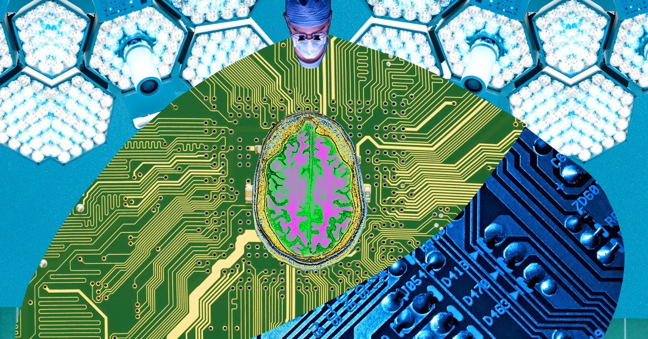 Your Next Job: Brain-Computer Interface Surgeon