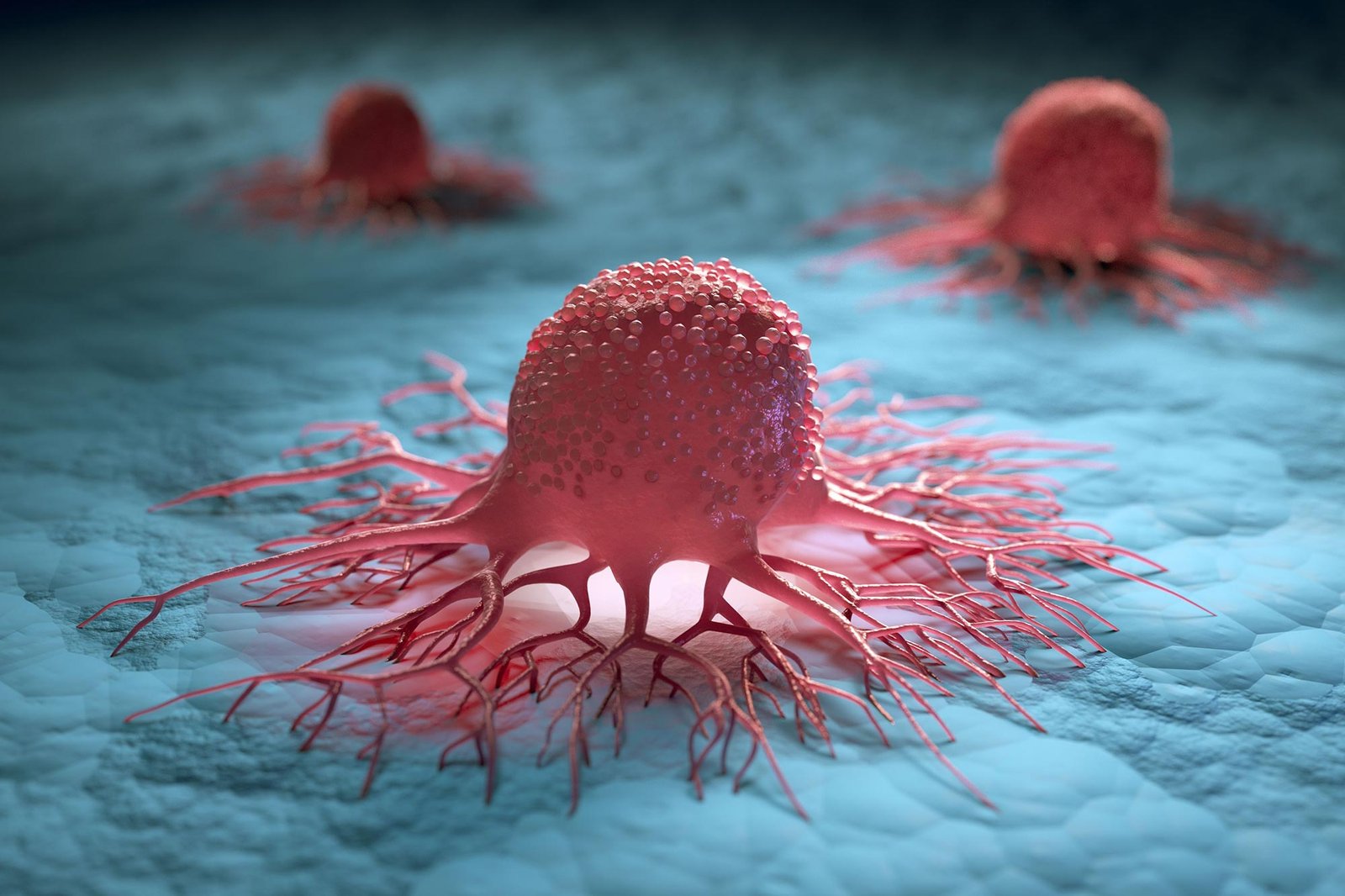 Surprising Origins for a Rare Cancer Uncovered