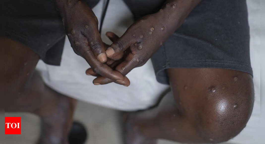 WHO declares mpox a global health emergency: What is mpox, can the virus spread, How can it be stopped