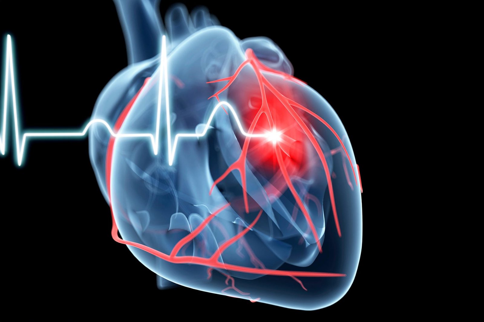 Work Stress Linked to a 97% Increased Risk of Irregular Heart Rhythm