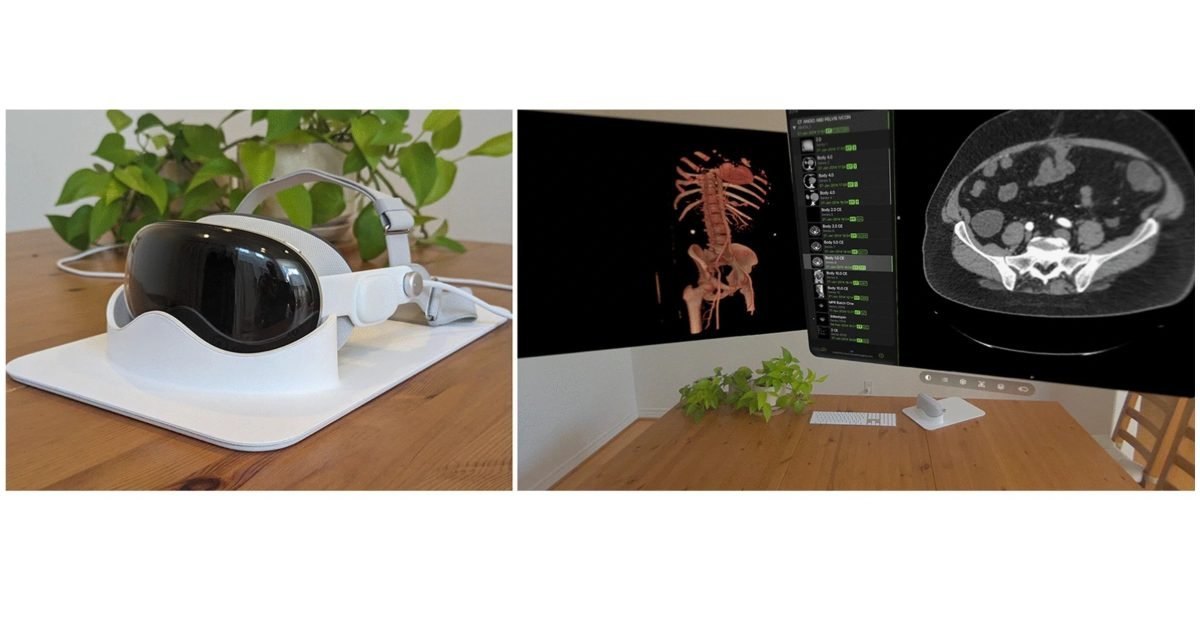 New Apple Vision Pro study reveals promising performance in radiology